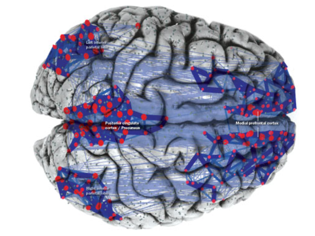 detección temprana del Alzheimer